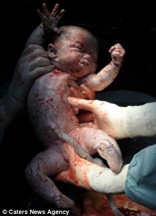 Taken before a mother has seen her baby for the first time these amazing photographs show the reality of how we all enter this world