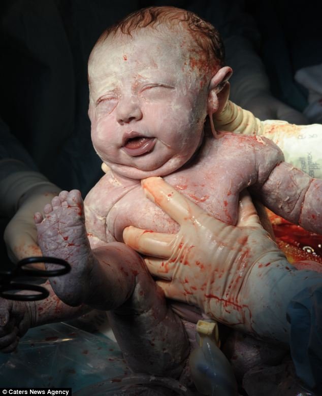 Focus: Respected Danish photographer Suste Bonnen followed 22 caesarian operations in Copenhagen University Hospital