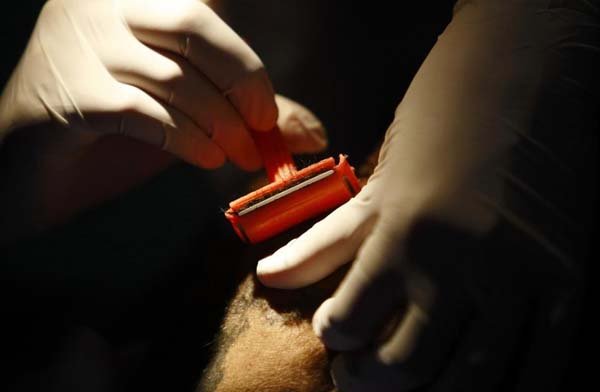 The procedures were non-invasive.