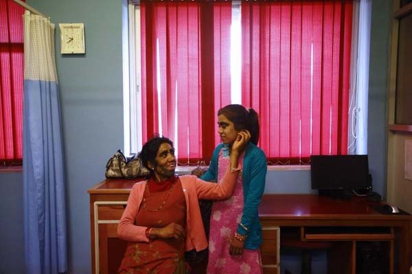 The doctors could remove the excess hair.